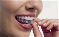 Invisalign